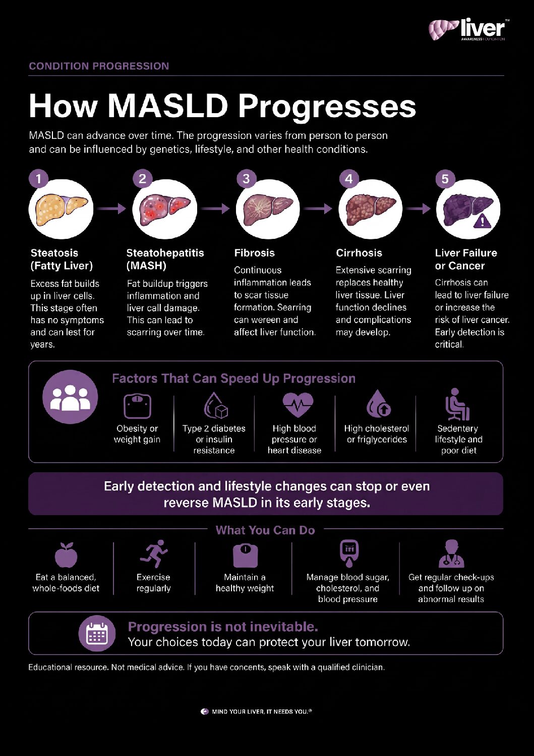 MASLD: How It Progresses
